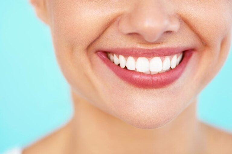 blanqueamiento dental – azul blanqueamiento dental - azul