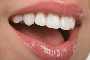 odontología estética en Villanueva del Pardillo - sonrisa