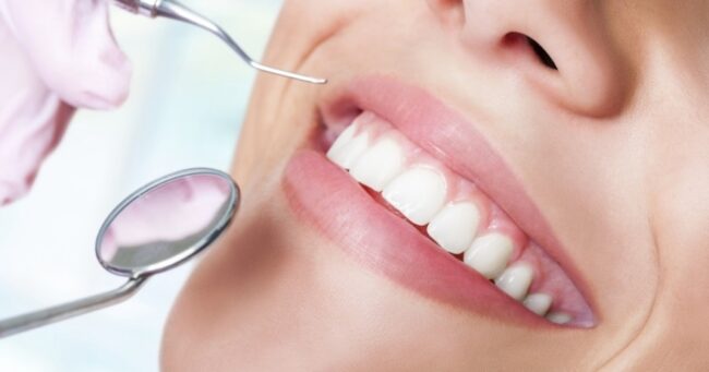clinica dental cerca de Majadahonda - blanqueamiento con luz fría