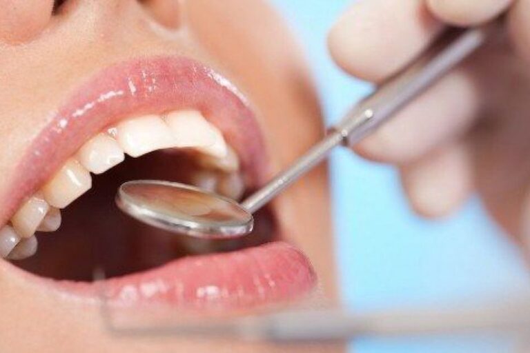 dentista cerca de Majadahonda – revisión anual dental