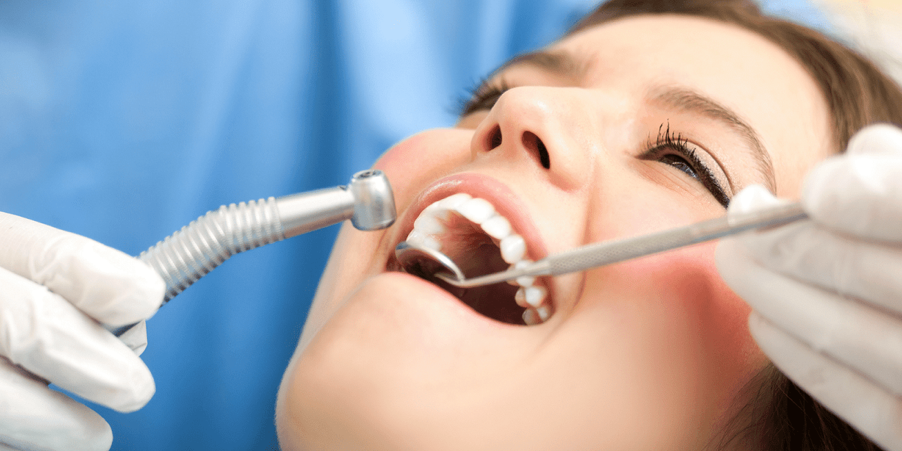 clínica dental cerca de Villafranca del Castillo – revisión dental clínica dental cerca de Villafranca del Castillo - revisión dental