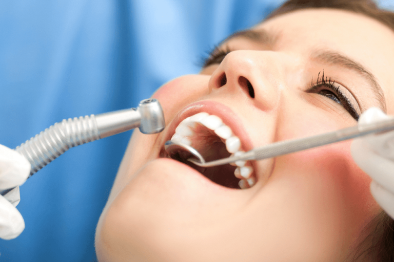 clínica dental cerca de Villafranca del Castillo – revisión dental clínica dental cerca de Villafranca del Castillo - revisión dental