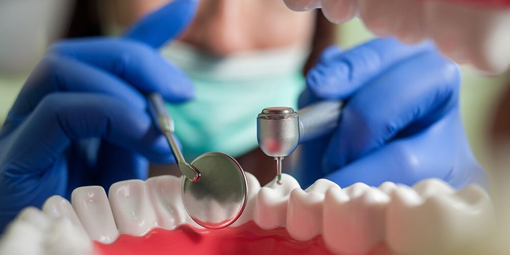 clinica dental cerca de Villanueva de la Cañada – dientes clinica dental cerca de Villanueva de la Cañada - dientes
