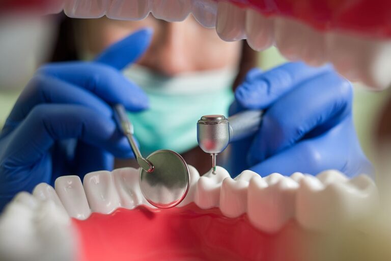 clinica dental cerca de Villanueva de la Cañada – dientes clinica dental cerca de Villanueva de la Cañada - dientes