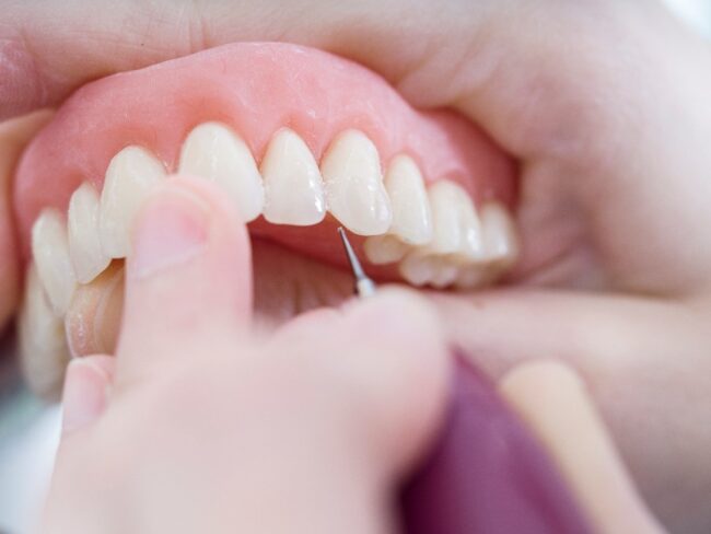 clinica dental en Brunete - trabajo con protesis