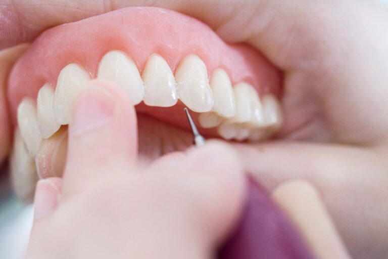 clinica dental en Brunete – trabajo con protesis clinica dental en Brunete - trabajo con protesis