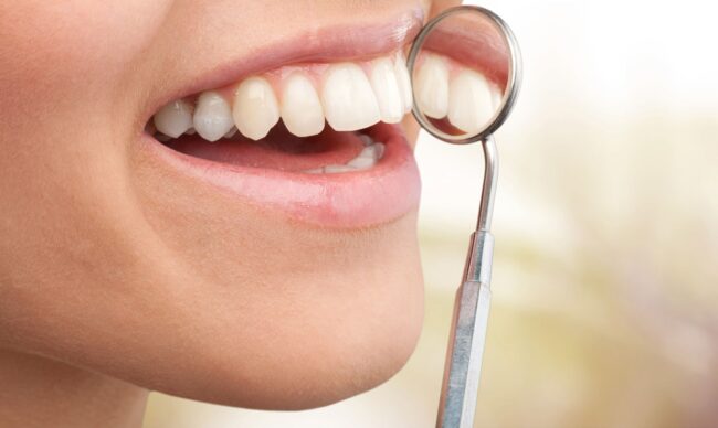 periodoncia en Villanueva del Pardillo - sonrisa con espejo