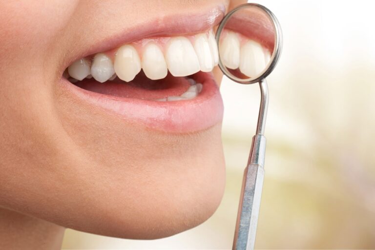 periodoncia en Villanueva del Pardillo – sonrisa con espejo periodoncia en Villanueva del Pardillo - sonrisa con espejo