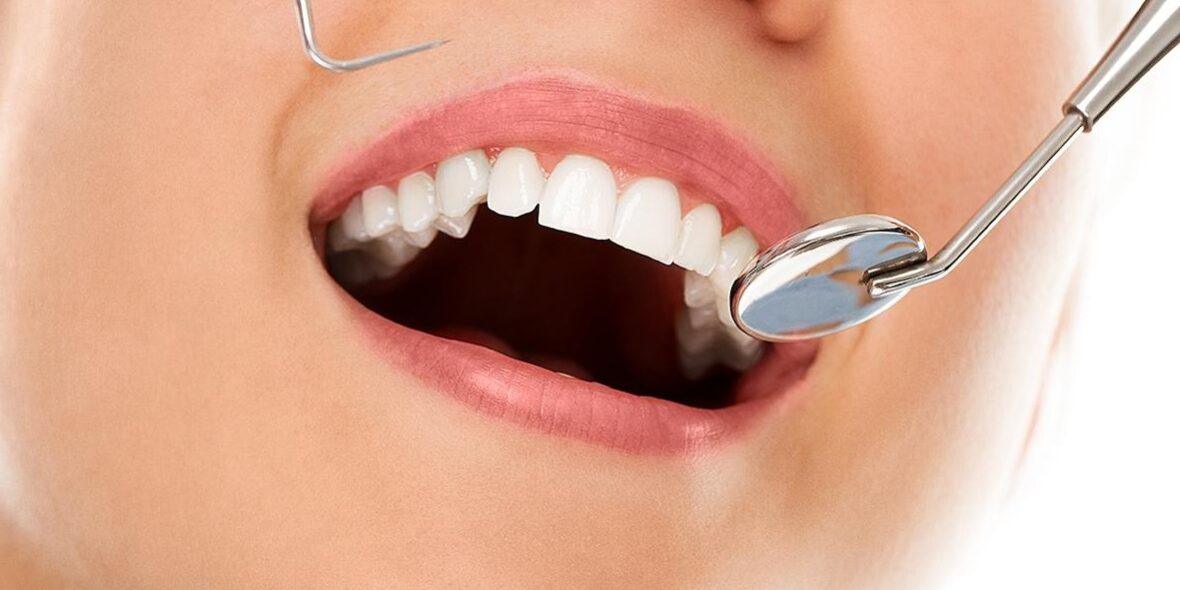 tratamiento de periodoncia cerca de Majadahonda - sonrisa blanca