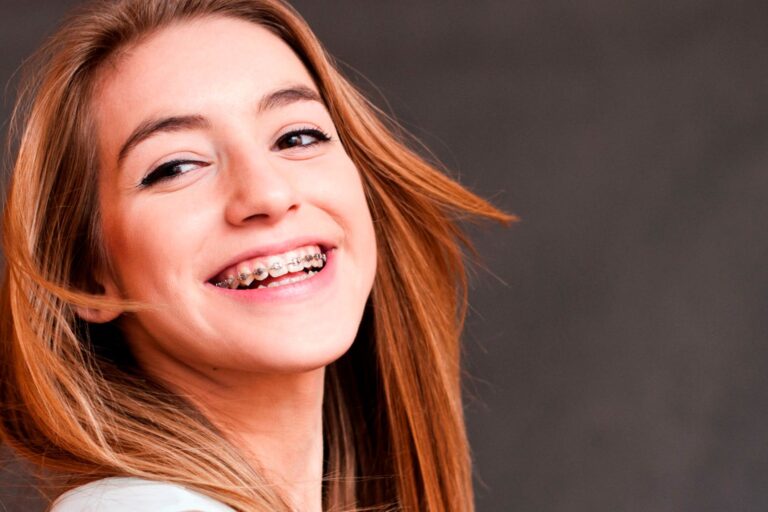 ortodoncia en Villanueva de la Cañada – chica con ortodoncia ortodoncia en Villanueva de la Cañada - chica con ortodoncia