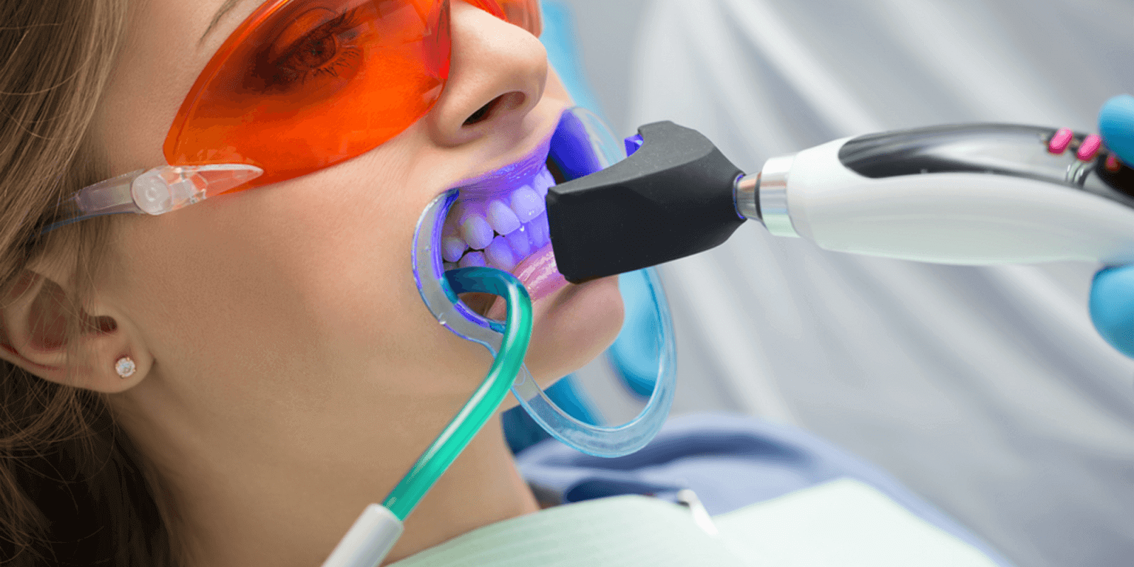 blanqueamiento dental led - chica con maquina