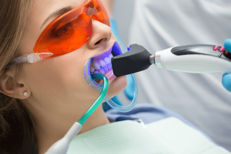 blanqueamiento dental led – chica con maquina blanqueamiento dental led - chica con maquina