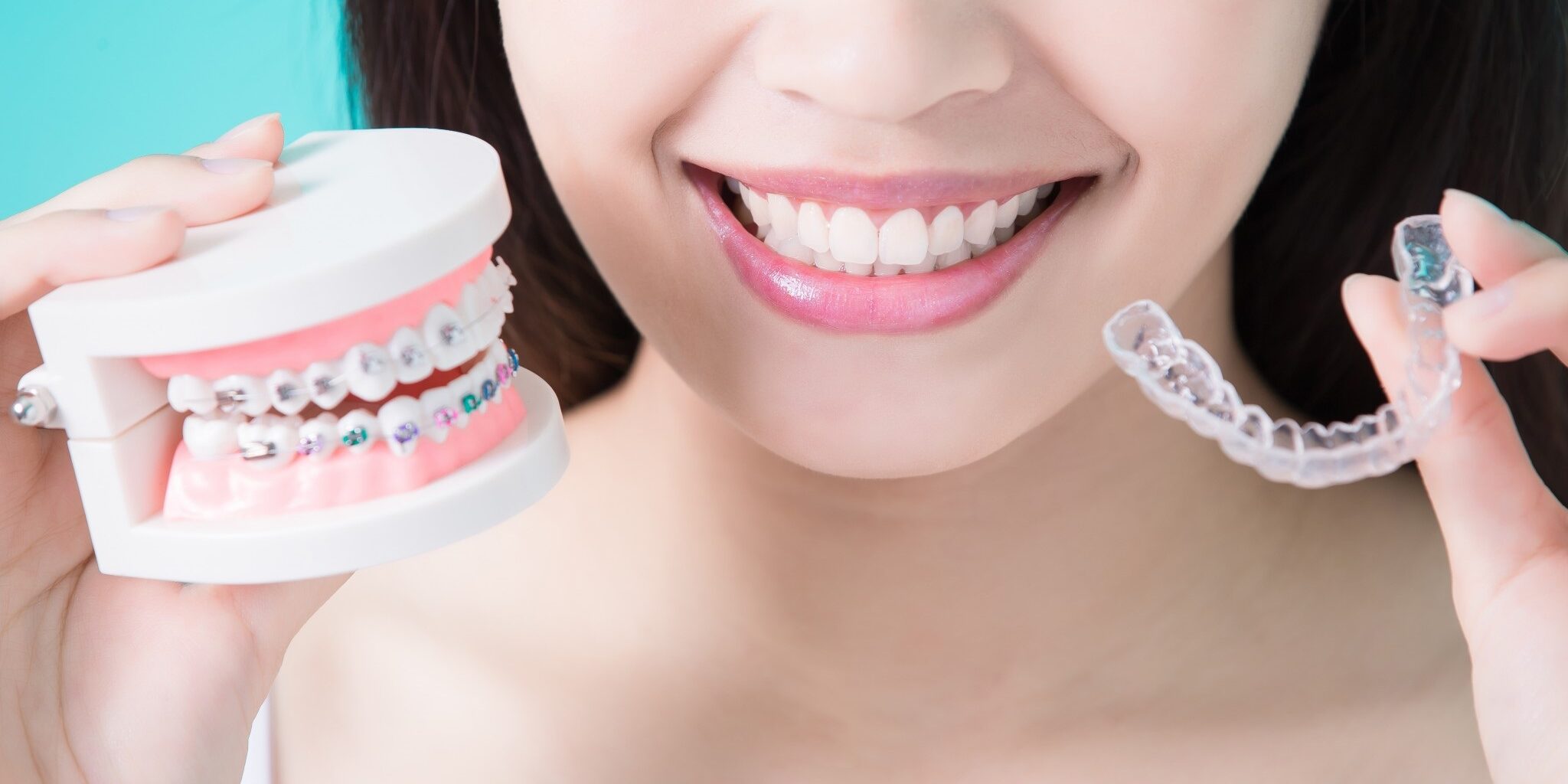 ortodoncia en Majadahonda – comparativa ortodoncia en Majadahonda - comparativa