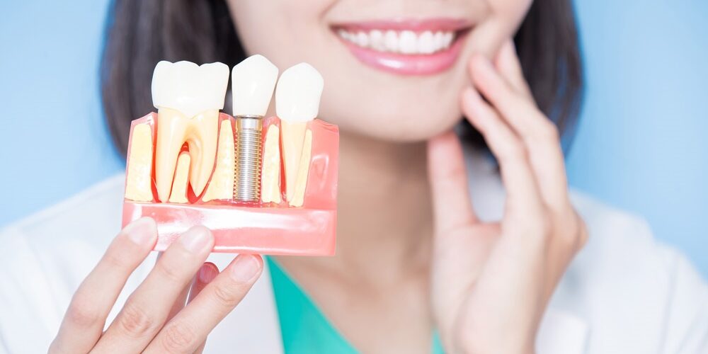 implantología y cirugía en Brunete - dientes protesicos