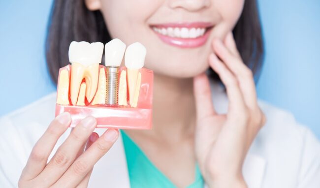 implantología y cirugía en Brunete - dientes protesicos