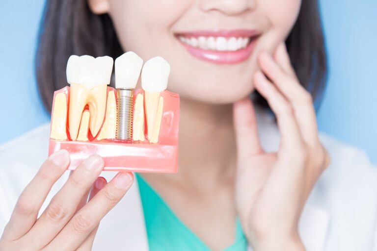 implantología y cirugía en Brunete – dientes protesicos implantología y cirugía en Brunete - dientes protesicos