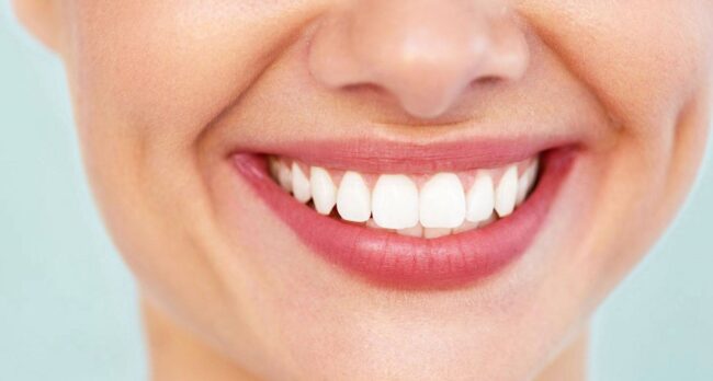 blanqueamiento dental - entrevista