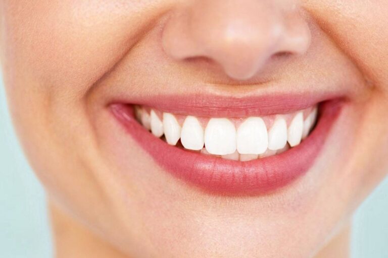 blanqueamiento dental – entrevista blanqueamiento dental - entrevista