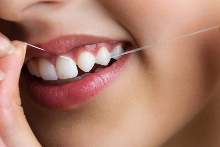 hilo dental – como utilizarlo hilo dental - como utilizarlo