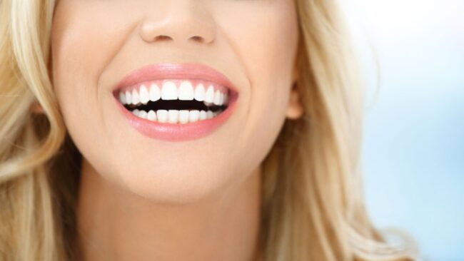odontologia estetica en Majadahonda - rubia sonriendo