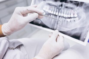 Dentista en Majadahonda - Rayos X