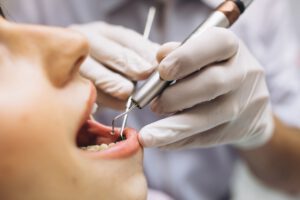 clinica dental en Villanueva de la cañada - boca