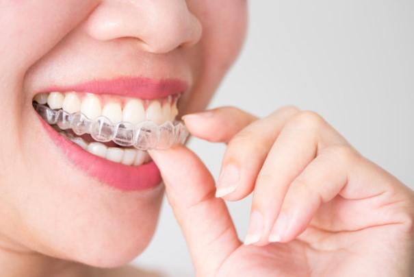 ortodoncia en majadahonda – invisible ortodoncia en majadahonda - invisible