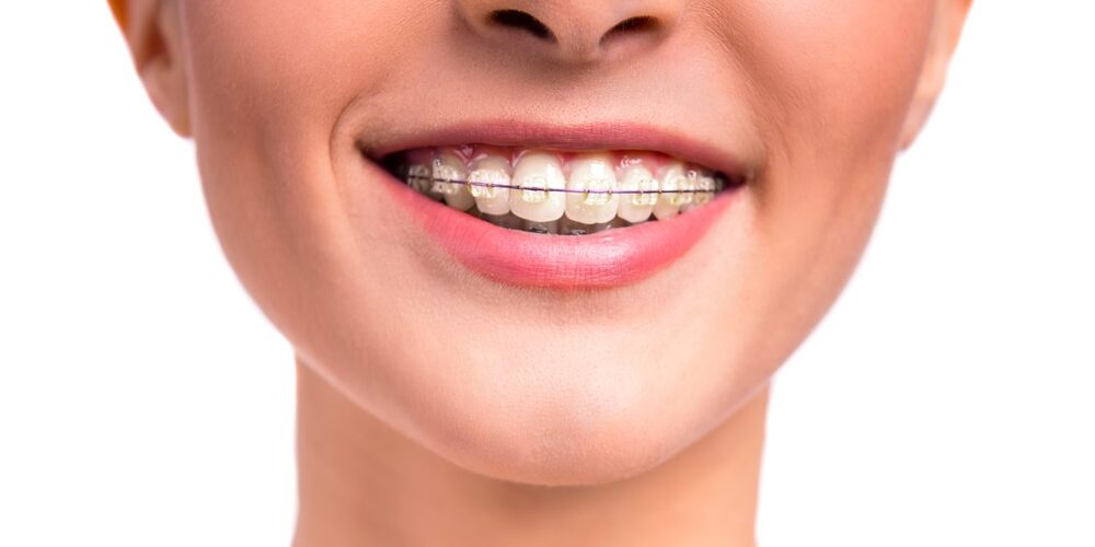 ortodoncia persona embarazada – ortodoncia ortodoncia persona embarazada - ortodoncia