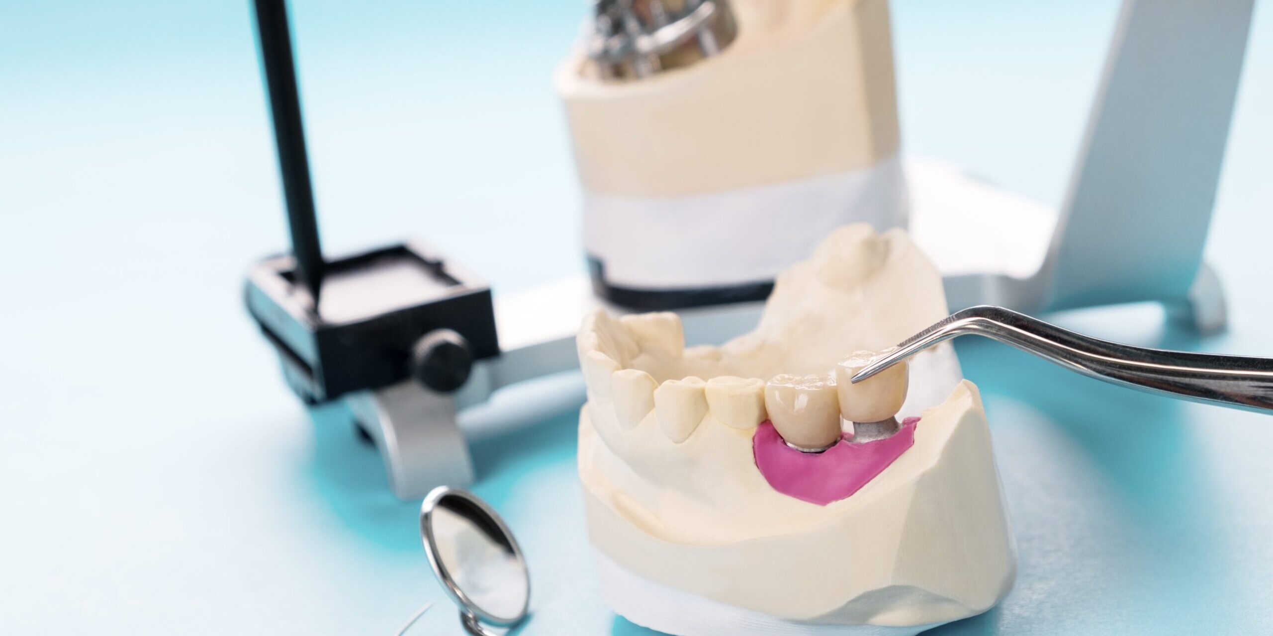 implantología y cirugía cerca de  Majadahonda – modelo de protesis implantología y cirugía cerca de Majadahonda - modelo de protesis