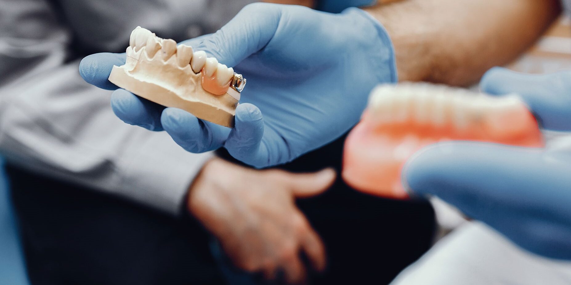 protesis dentales en Villanueva de la cañada – manos de médico protesis dentales en Villanueva de la cañada - manos de médico