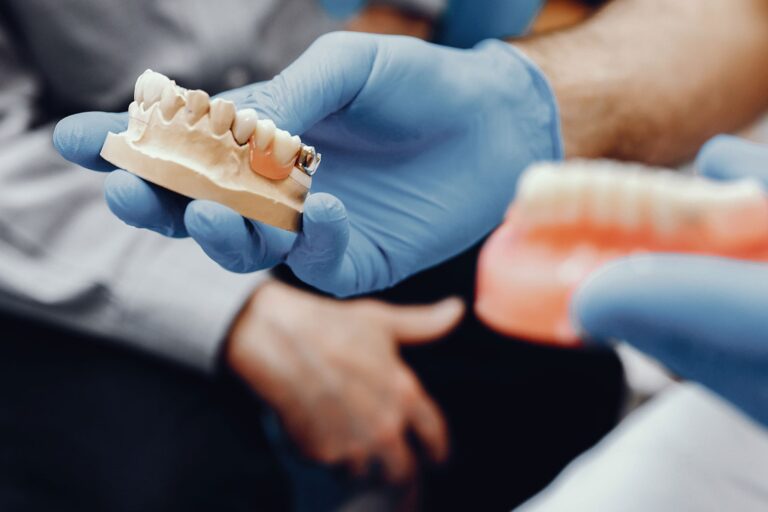 protesis dentales en Villanueva de la cañada – manos de médico protesis dentales en Villanueva de la cañada - manos de médico