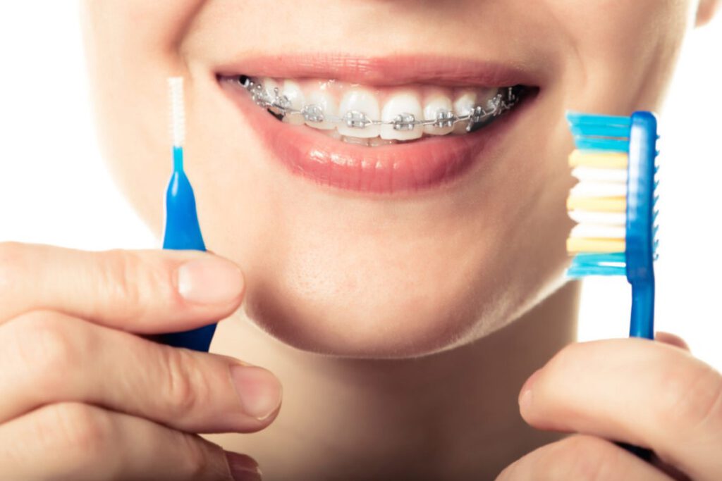 ¿En Qué Consiste La Buena Higiene En La Ortodoncia? - Like Dental