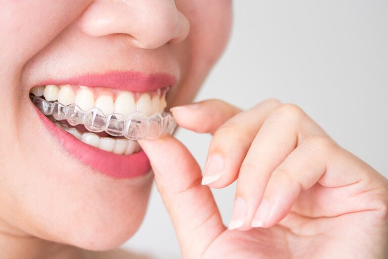 Ortodoncia removible