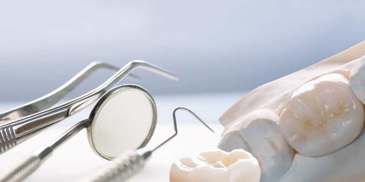 protesis dentales cerca de Majadahonda - aparatología