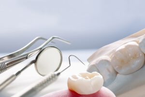protesis dentales cerca de Majadahonda - aparatología