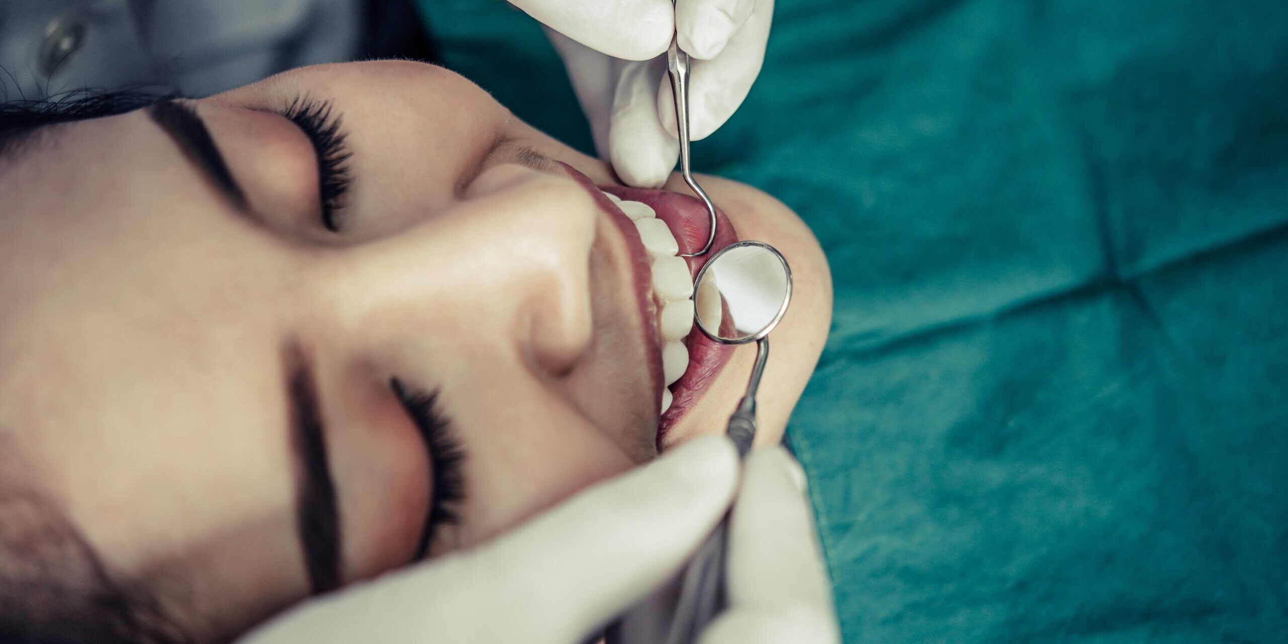 ortodoncia majadahonda - limpieza