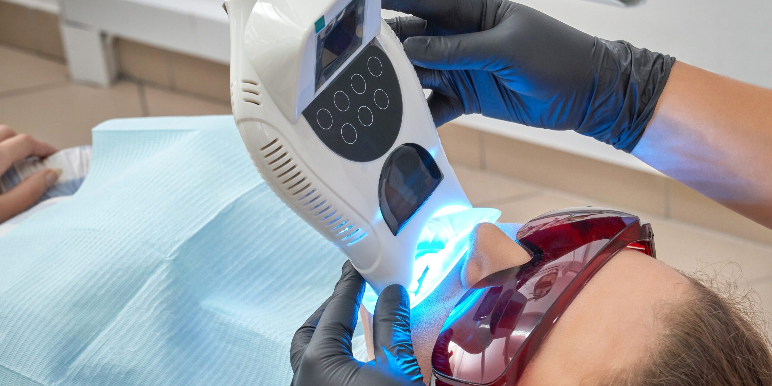 blanqueamiento en villanueva del pardillo – lampara blanqueamiento en villanueva del pardillo - lampara