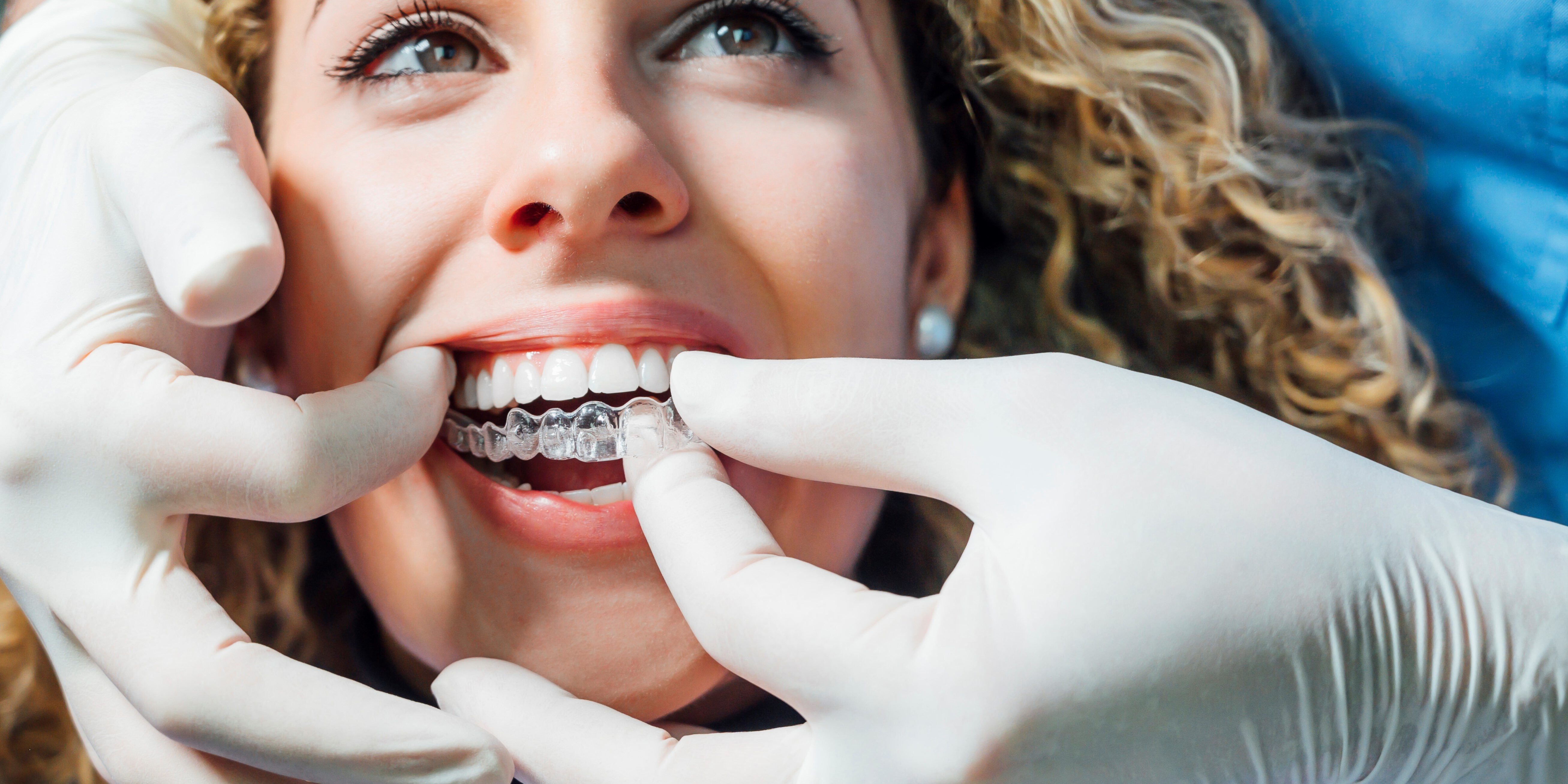 Qué beneficios tiene la férula de descarga? - Dentista en Plasencia