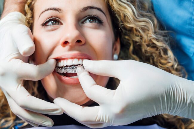 ferulas de descarga en Majadahonda - colocación