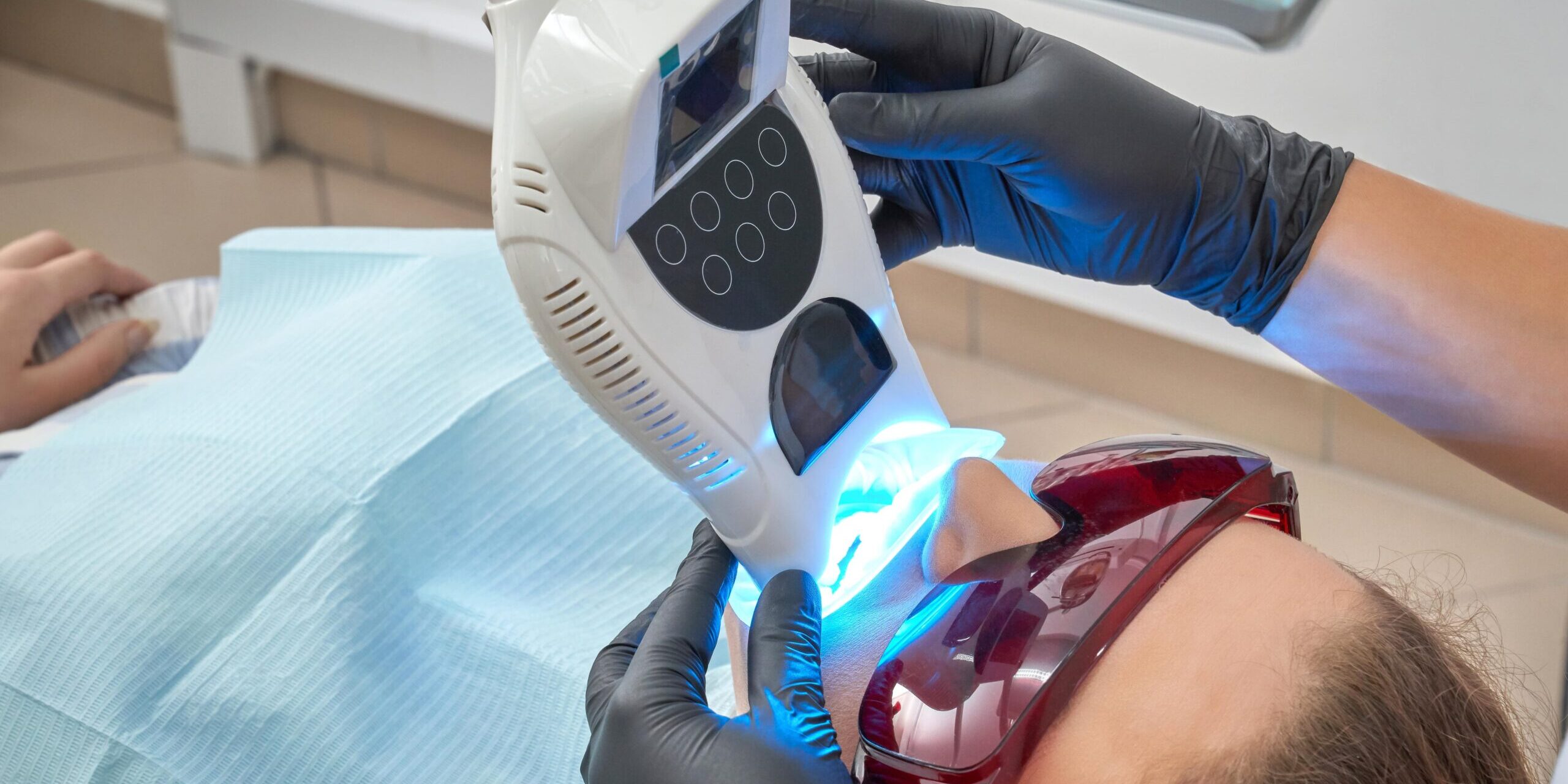 blanqueamiento dental en Majadahonda – linterna blanqueamiento dental en Majadahonda - linterna