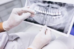 dentista cerca de Majadahonda - profesional-