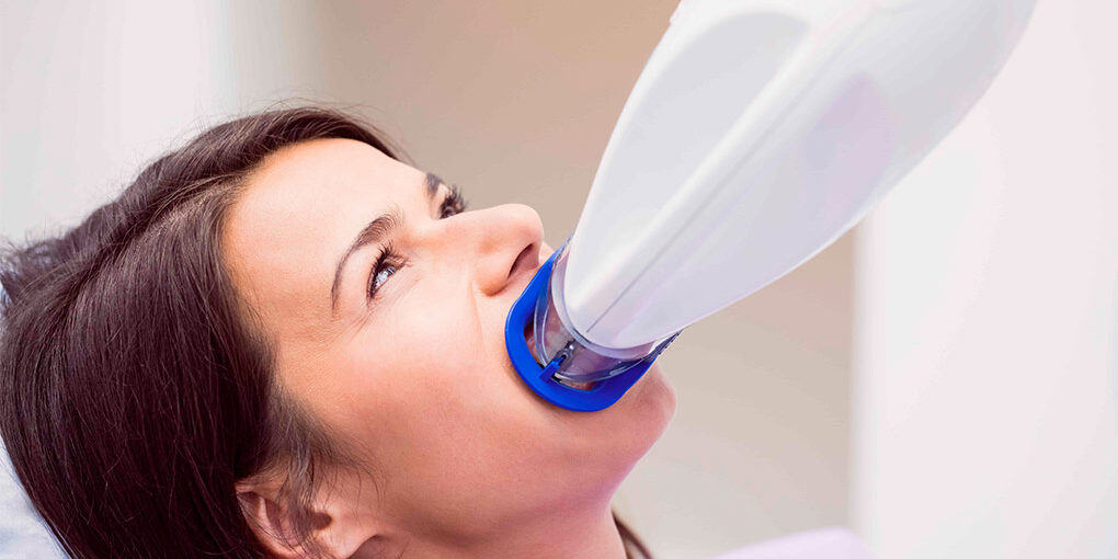 blanqueamiento-dental-en-majadahonda—proceso blanqueamiento-dental-en-majadahonda---proceso