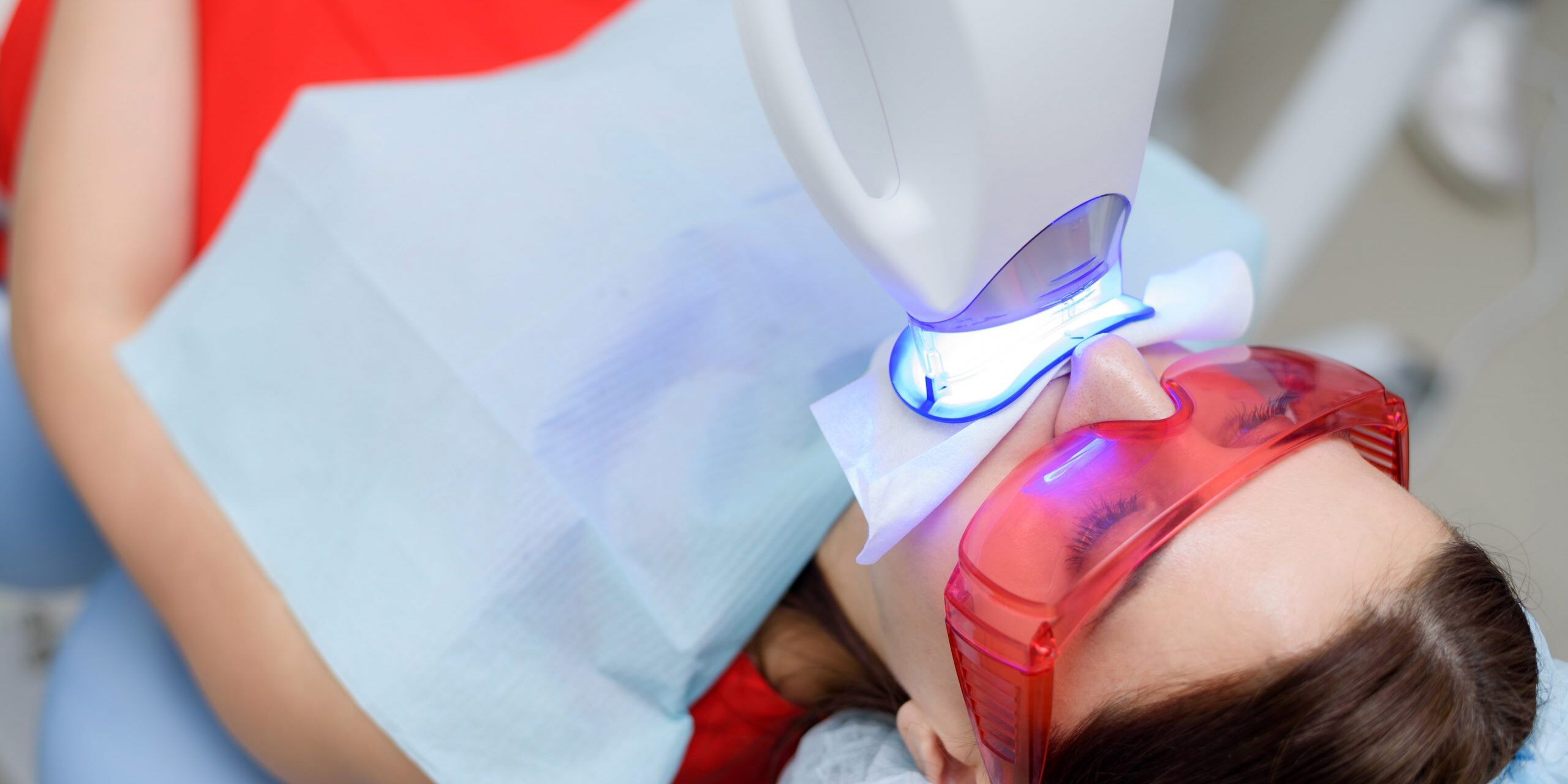 qué es el blanqueamiento dental con luz fría - mujer