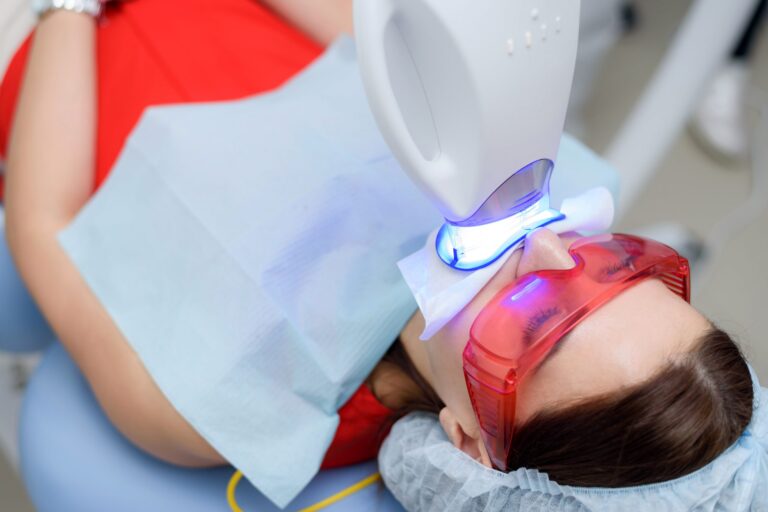 qué es el blanqueamiento dental con luz fría – mujer qué es el blanqueamiento dental con luz fría - mujer