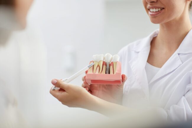 qué es el implante inmediato - explicación