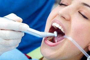 limpieza dental en Villanueva del pardillo - mujer con dientes blancos