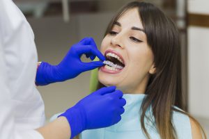 por quÃ© hay que usar retenedores tras una ortodoncia - doctora probando los retenedores