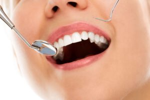 consejos para encÃ­as sanas. - revision dental
