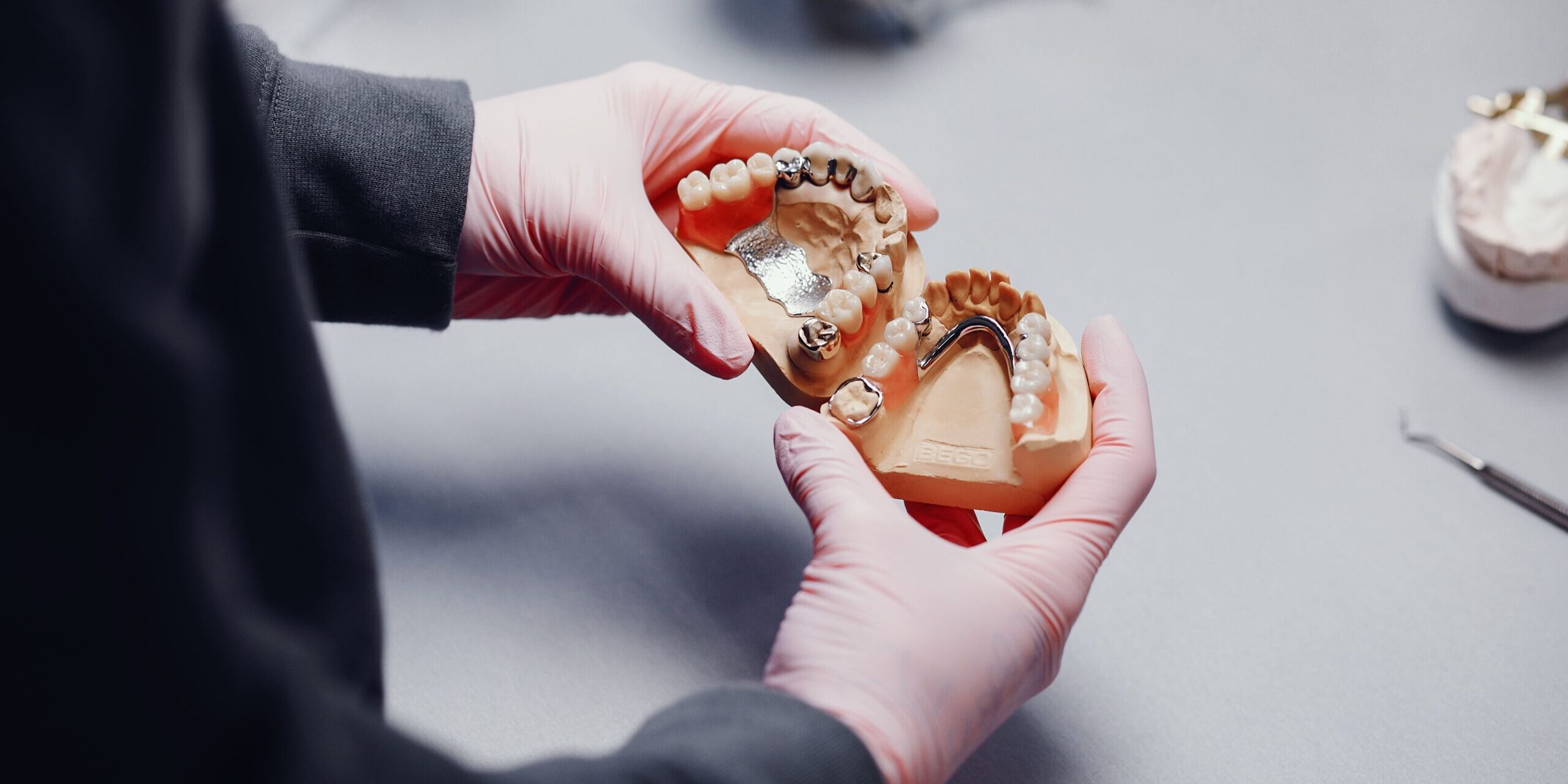 prótesis dental Brunete – prototipo prótesis dental Brunete - prototipo