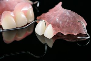 Tipos de prótesis dentales - removible